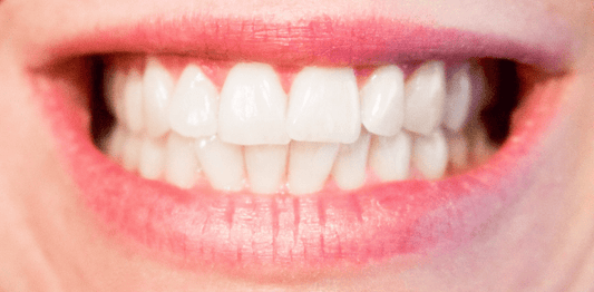 Demonstration of jaw exercises aimed at improving TMJ mobility and reducing bruxism effects