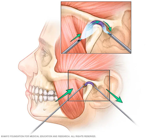 Individual performing jaw relaxation exercises to alleviate TMJ discomfort